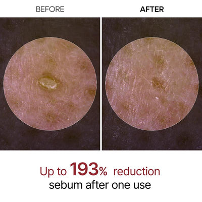 Dr.Melaxin - Peel Shot Glow Rice Ampoule Duo (Black + White)