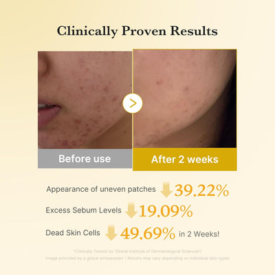 Medicube Kojic Acid Turmeric Power Duo
