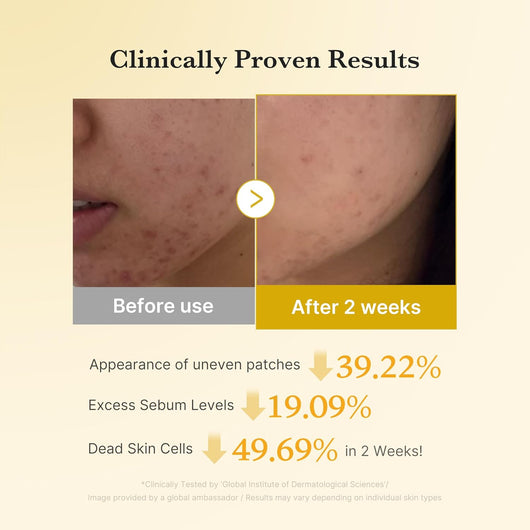 Medicube Kojic Acid Turmeric Power Duo