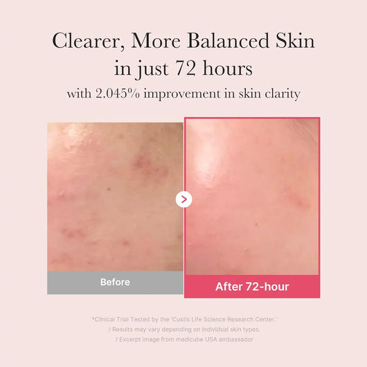 Medicube TXA+Niacinamide 15 Glow Facial Serum 30mL
