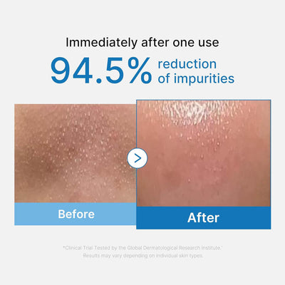 Medicube Zero Pore Blackhead Deep Cleansing Oil 205mL
