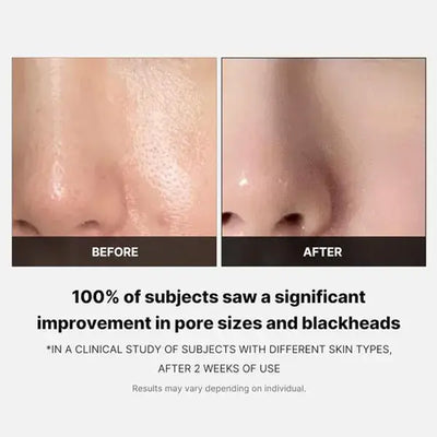 Medicube Zero Pore Pad (70 Pads)