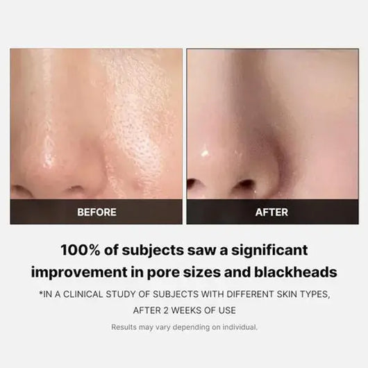 Medicube Zero Pore Pad (70 Pads)