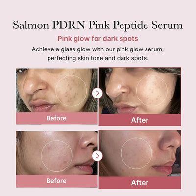 Medicube PDRN Pink Peptide Glow Serum 30mL