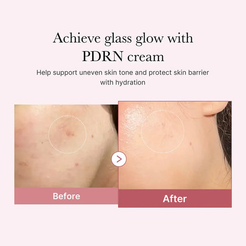 Medicube Salmon DNA PDRN Pink Hyaluronic Moisturizing Cream 50mL